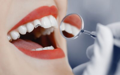 How To Manage A Chipped Tooth (Emergency Treatment)