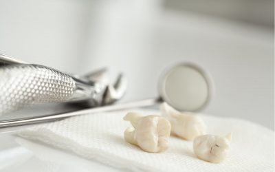 What Should Be Done For A Wisdom Tooth Extraction Infection?